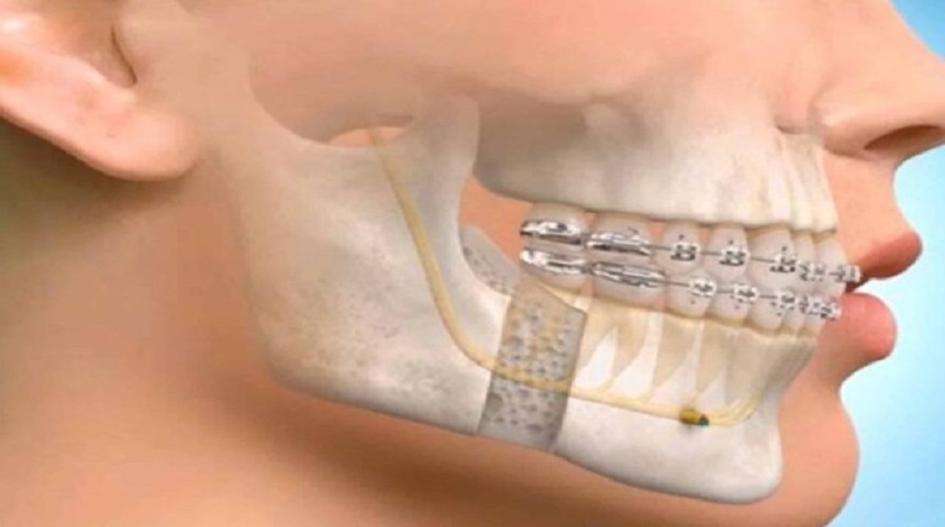 Oral and Maxillofacial Surgery banner 860x480