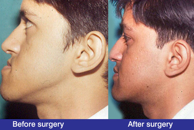 Oral and Maxillofacial Surgery