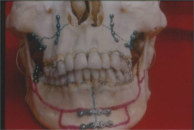 trauma-img-1