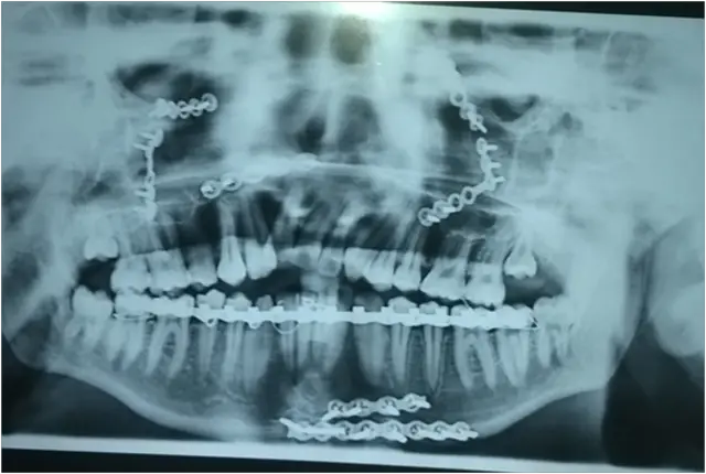 trauma-img-3